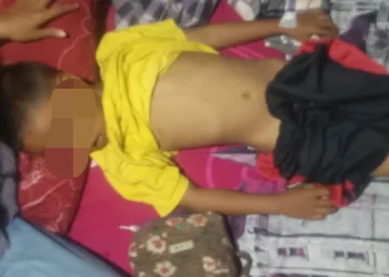 Viral! Bocah 7 Tahun Jadi Korban Kekerasan Brutal di Sekolah